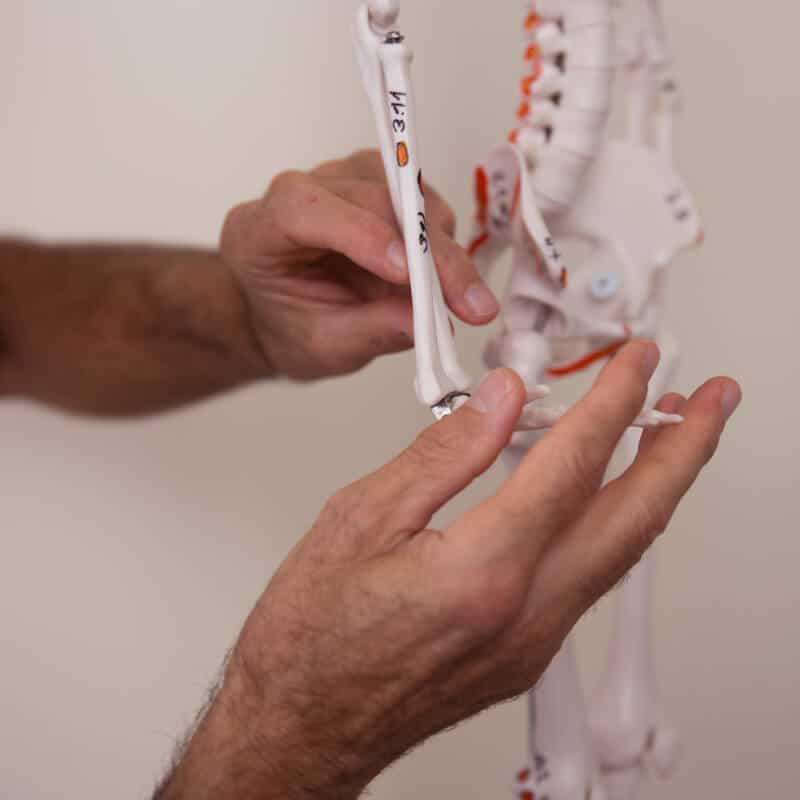 Facet syndrome