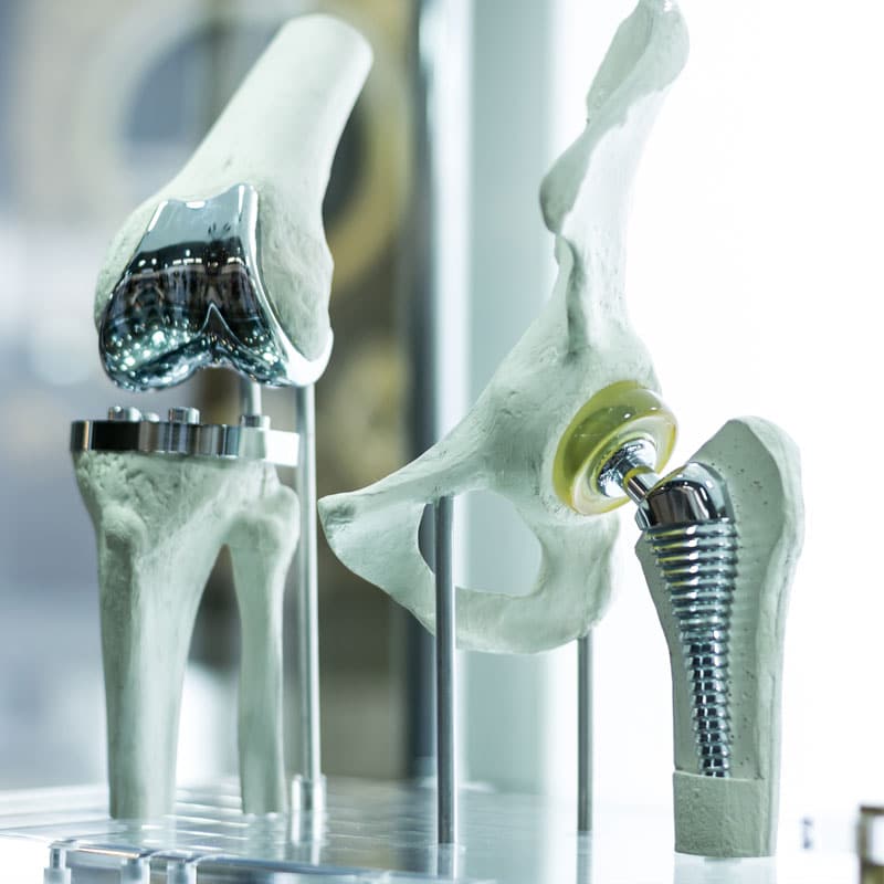 Artificial knee joint