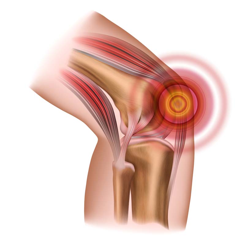 anatomy of the knee with pain in the knee cap
