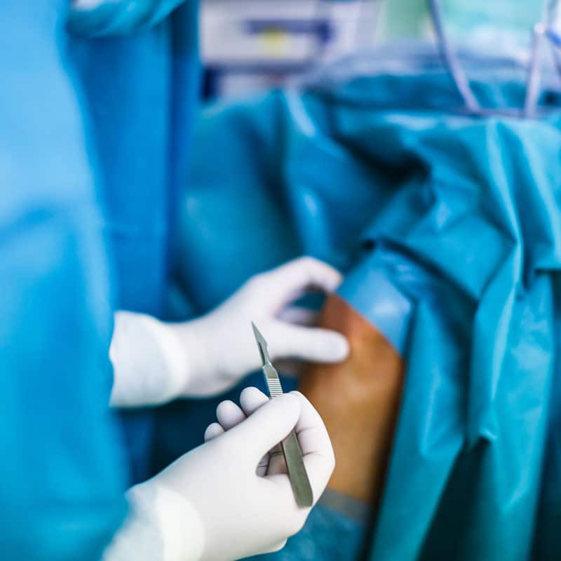 Knee Surgery