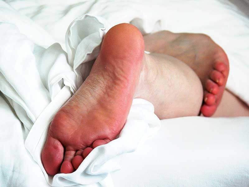 Reddened feet in a bed.