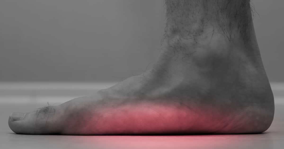 This is a picture of a flat foot.