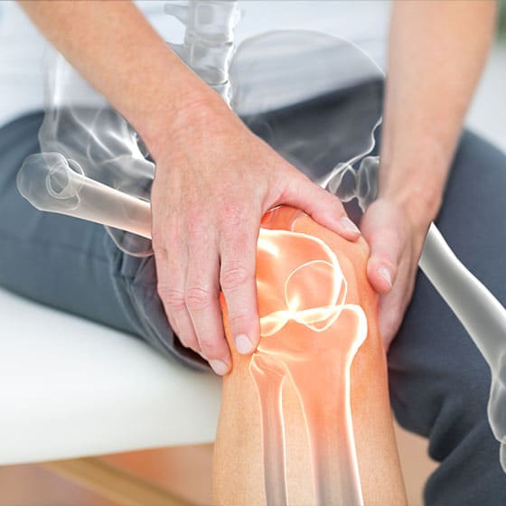 knee osteoarthritis