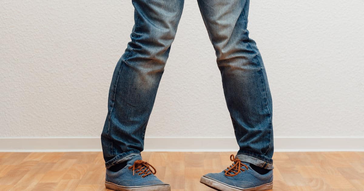 Closeup of a person with knock knees (genu valgum).
