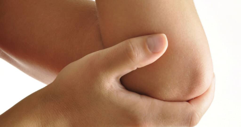 Closeup of a woman touching her elbow.