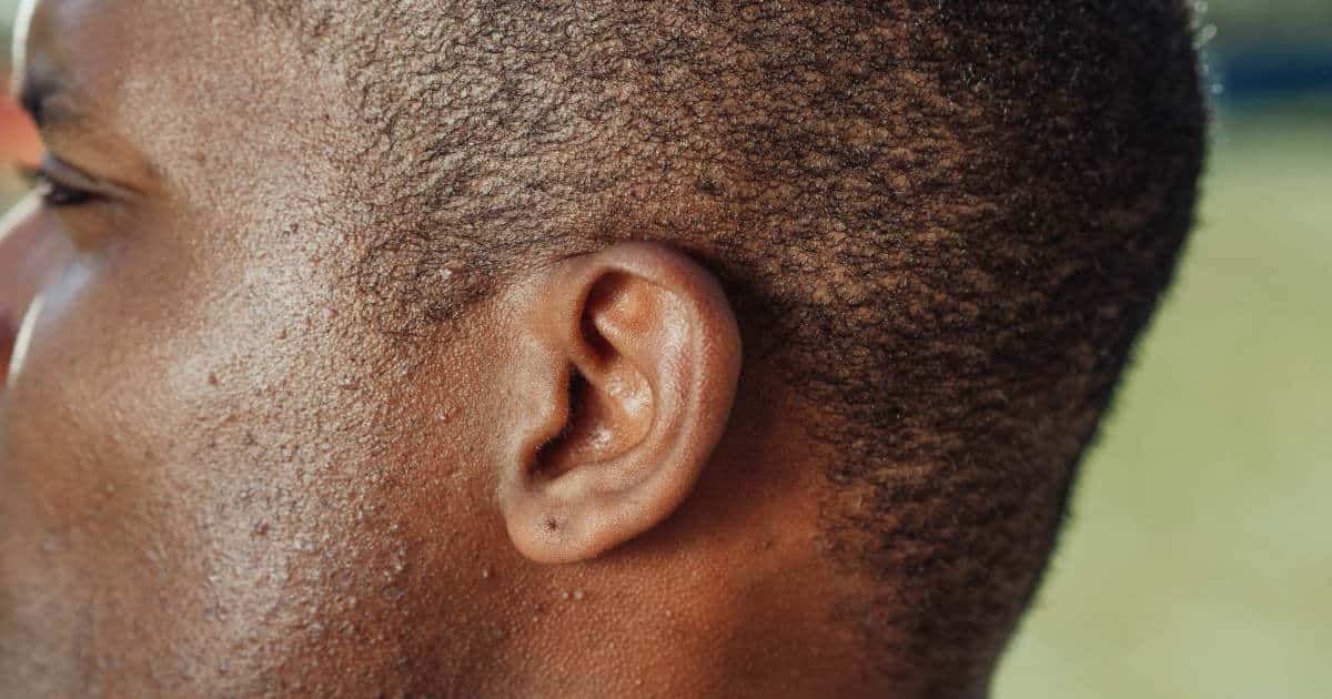 Closeup of an ear.