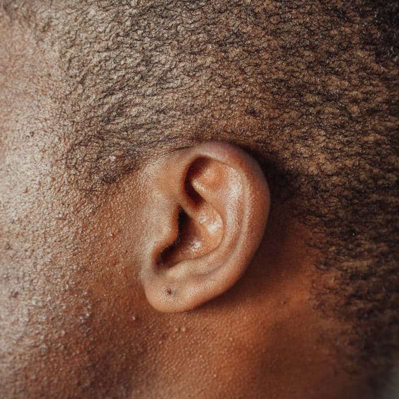 Closeup of an ear.