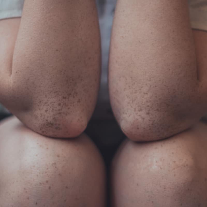 Closeup of two elbows resting on knees.