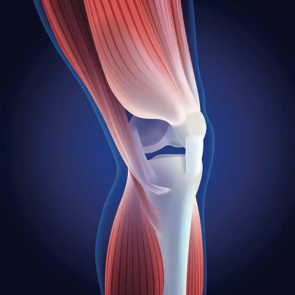 Graphic of a leg bone and muscles