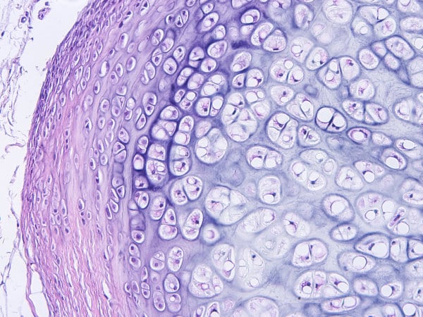 Histologie des Bindegewebes des menschlichen Knorpels, Foto von Hyalin und elastischem Knorpel aus Mikroskop-Sicht