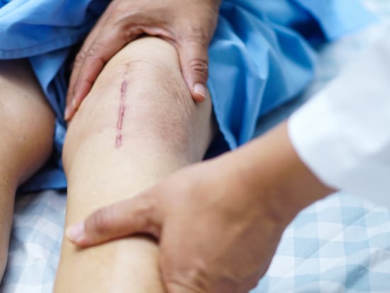 Bein mit langer Operationsnarbe am Knie, Hände von Arzt oder Therapeut betasten Bein