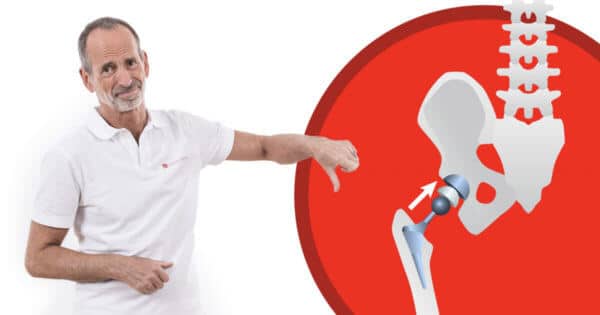 Roland Liebscher-Bracht erklärt, warum ein künstliches Hüftgelenk oft unnötig ist