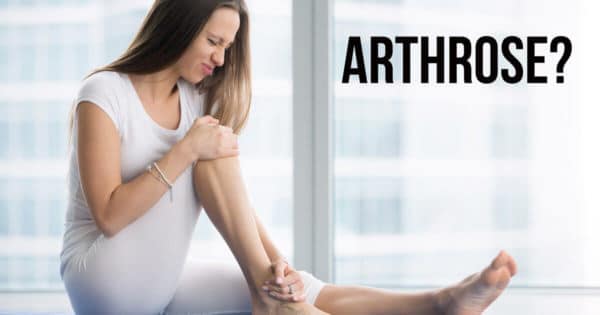 Eine Frau hält sich ihr Knie vor Arthrose-Schmerzen