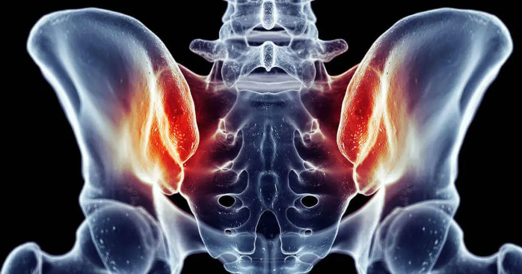 Anatomische Darstellung mit rot eingefärbten ISG (Iliosakralgelenk) zwischen Becken und Lendenwirbelsäule.
