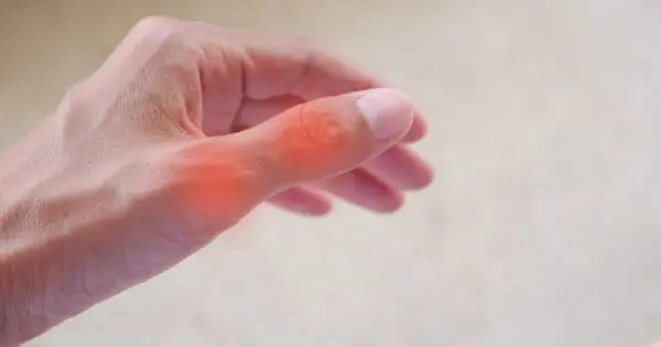 Foto von einem schmerzenden Daumen bei Handschmerzen