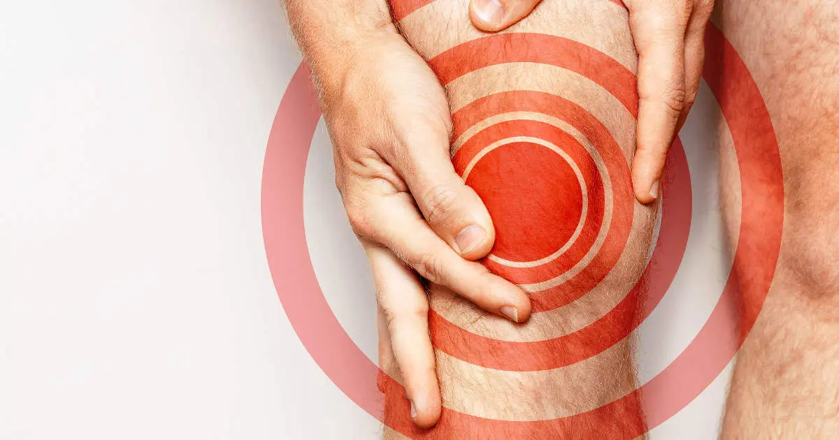 Mann mit Knieschmerzen, die durch rote Kreise symbolisiert werden. Kniegelenksarthrose verursacht Schmerzen im Knie