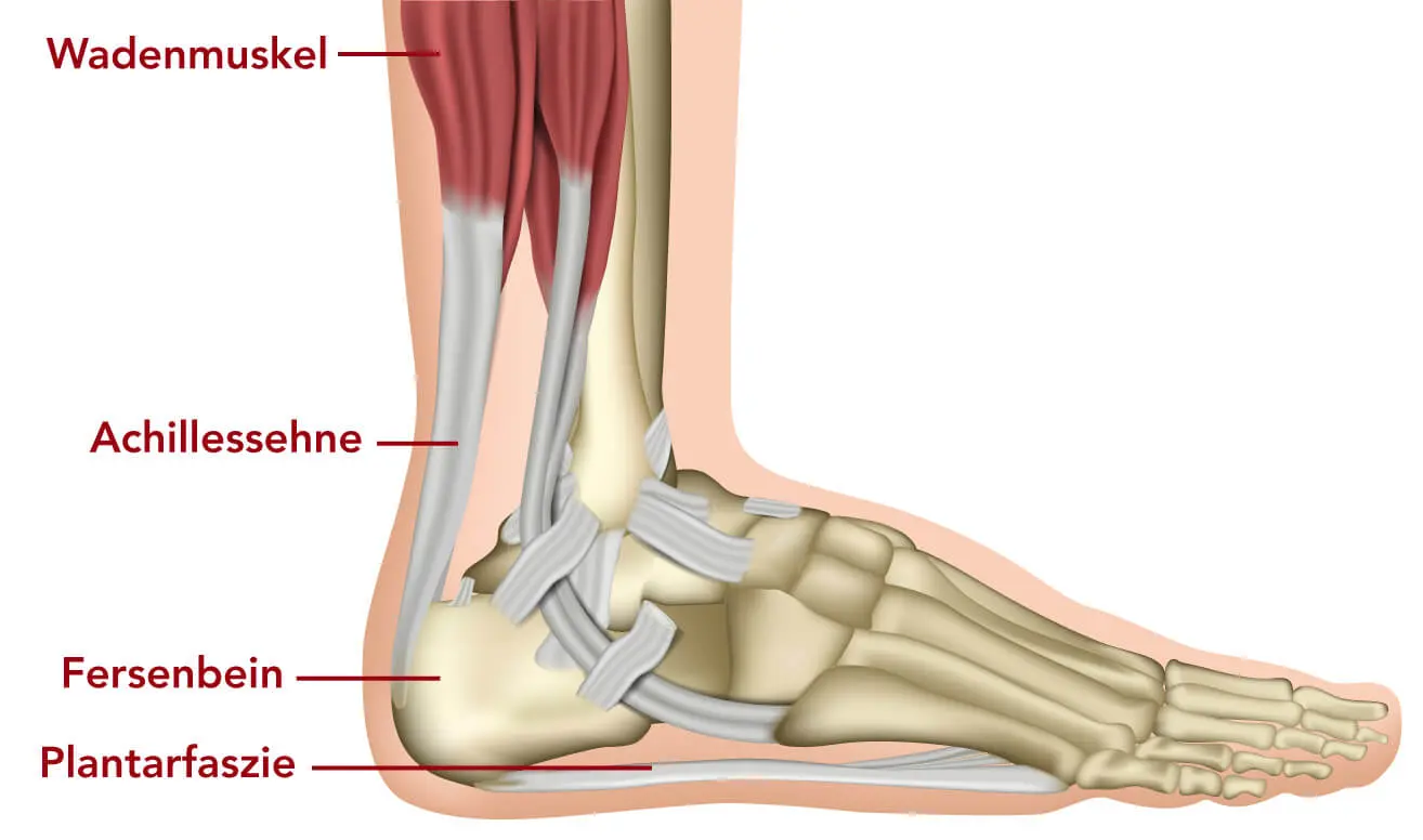Plantarfasziitis Die häufigste Ursache von Fersenschmerzen Liebscher & Bracht