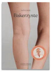 Schmerzfrei Ratgeber Bakerzyste
