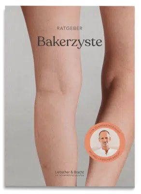 Schmerzfrei Ratgeber Bakerzyste
