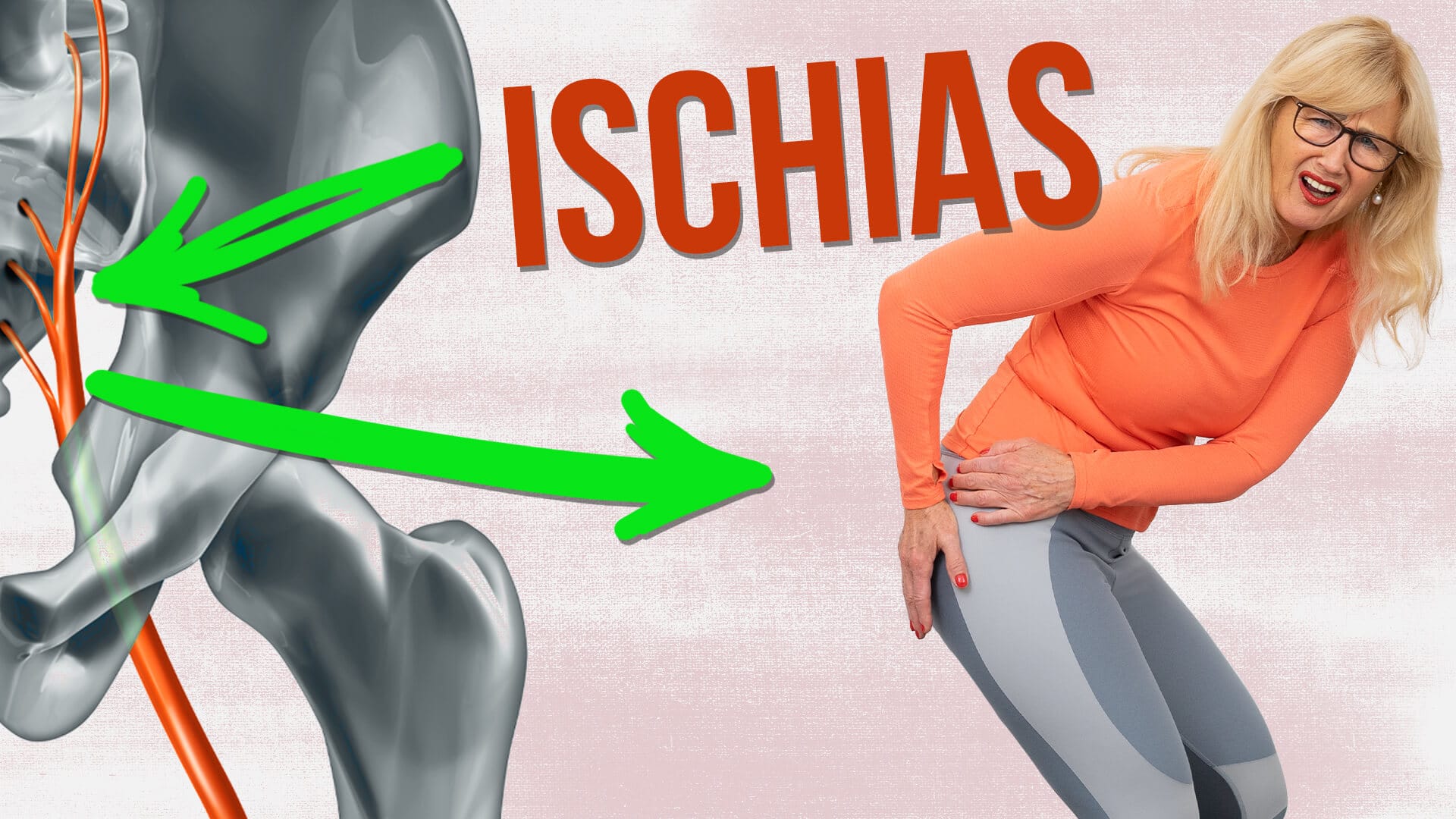Schlechter werden Kann ignoriert werden Schurke spritze gegen ischias Rezeption Abschleppen schlank Schlechter werden Kann ignoriert werden Schurke spritze gegen ischias Rezeption Abschleppen schlank