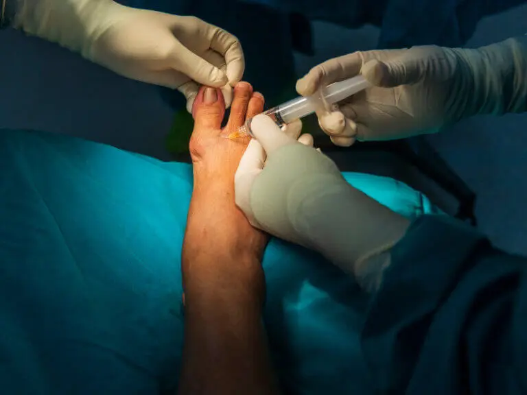 Hallux rigidus Behandlung & Übungen LiebscherBracht
