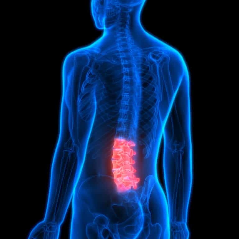 Rückenschmerzen - Ursachen, Behandlung und Übungen | Liebscher & Bracht