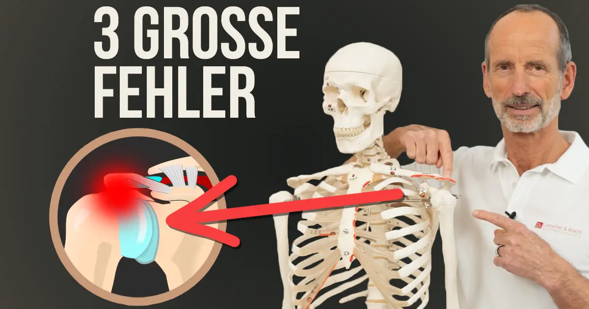SchulterImpingement lösen Vermeide diese 3 Fehler Liebscher & Bracht SchulterImpingement lösen Vermeide diese 3 Fehler Liebscher & Bracht