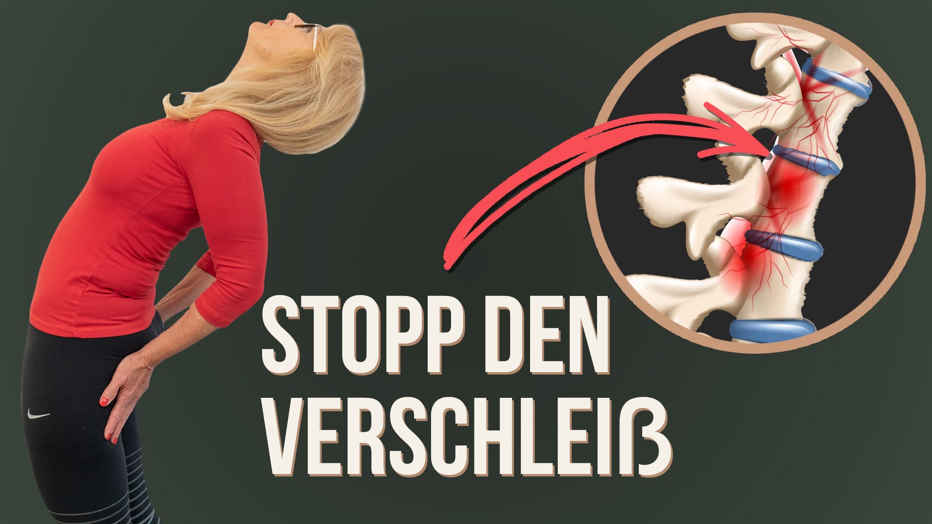 Bandscheibe retten: So kannst du Verschleiß stoppen | Liebscher & Bracht