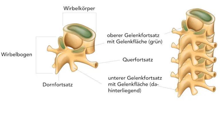 Spondylarthrose & Facettensyndrom stoppen | Liebscher & Bracht