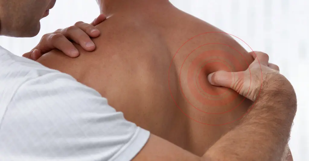 Ein Therapeut behandelt einen Triggerpunkt an der Schulter mit dem Daumen