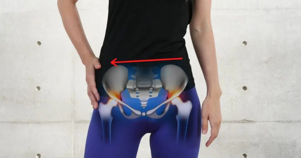 Eine Frau hält sich mit einer Hand die Hüfte, anatomische Grafik der Hüftgelenke