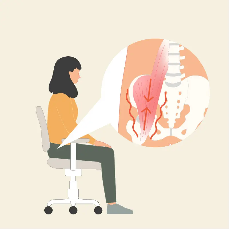 Die gezeichnete Grafik zeigt eine Frau im ockerfarbenen Oberteil, die auf einem Bürostuhl sitzt. In einer Vergrößerungslupe ist eine Zeichnung des Beckens mit eingezeichneten Hüftbeugern zu sehen. Pfeile verdeutlichen die Verkürzungen der Hüftbeuger.