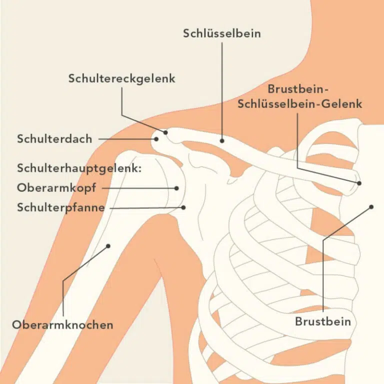 Schulterarthrose (Omarthrose) Entstehung und Behandlung Liebscher & Bracht