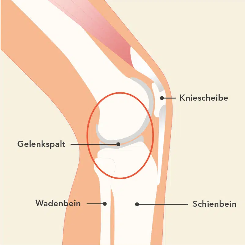 Grafik eines Knies von der Seite. Oberschenkel und Unterschenkel treffen aufeinander und bilden das Kniegelenk.