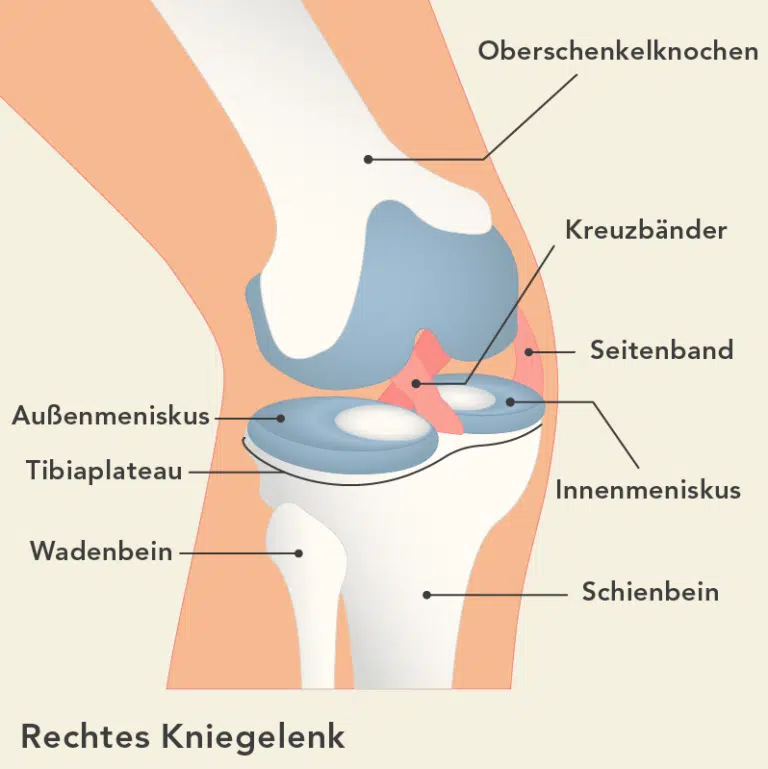 Knieschmerzen außen verstehen und loswerden Liebscher & Bracht