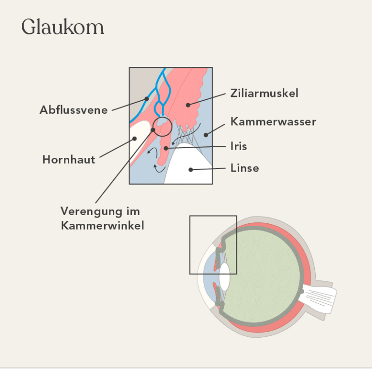 Augenschmerzen Ursachen Die Entstehung Im Blick Liebscher Bracht augenschmerzen-ursachen-die-entstehung-im-blick-liebscher-bracht