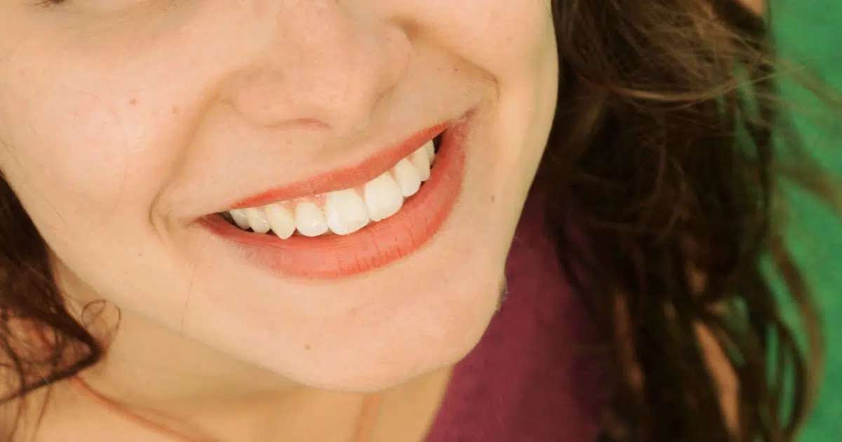 Eine junge Frau lächelt und zeigt ihre gesunden Zähne.