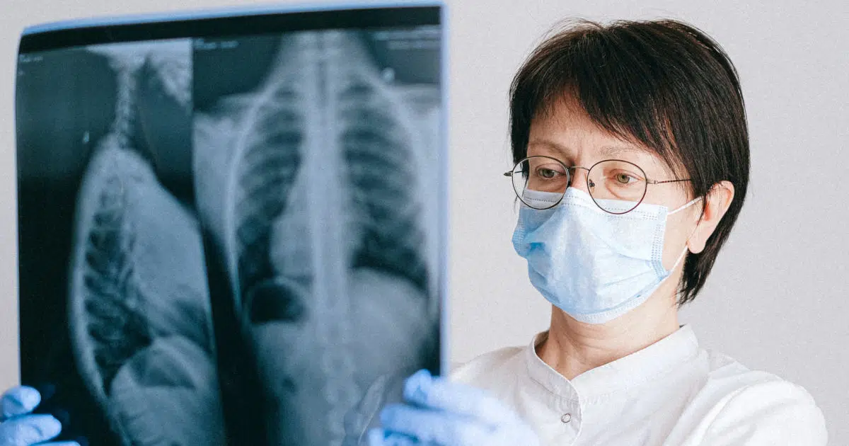 Eine Ärztin hält ein Röntgenbild in der Hand und betrachtet es. Auf dem Bild ist der Brustkorb sichtbar und das Herz.