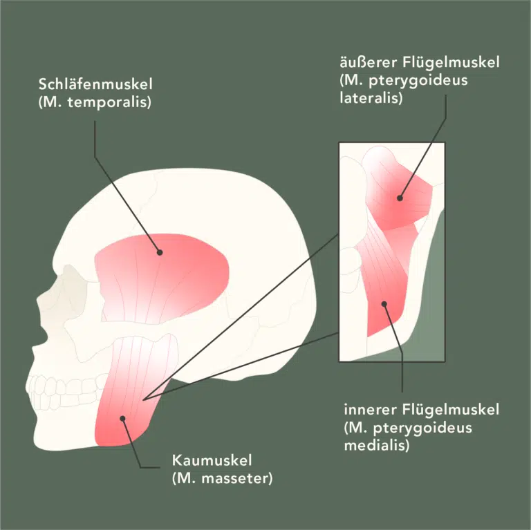 Zähneknirschen Ursachen: So entsteht Bruxismus | Liebscher & Bracht