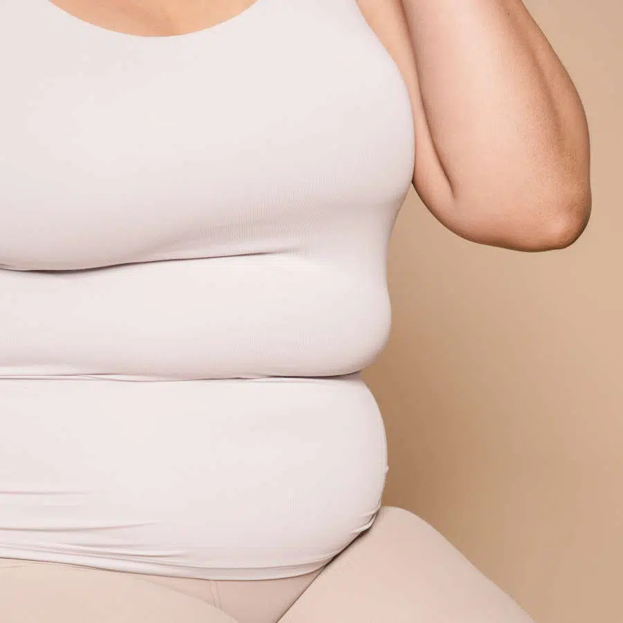 Zu sehen ist der Oberkörper einer Frau mit zwei Speckrollen um den Bauch