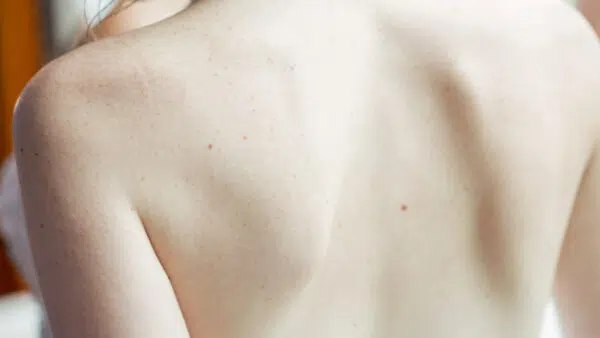 Der Betrachter schaut auf den oberen nackten Rücken einer weißen Frau.