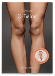 Ratgeber Cover X-Beine