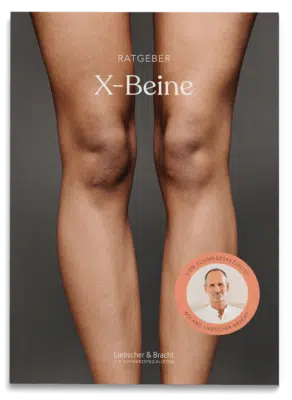 Ratgeber Cover X-Beine