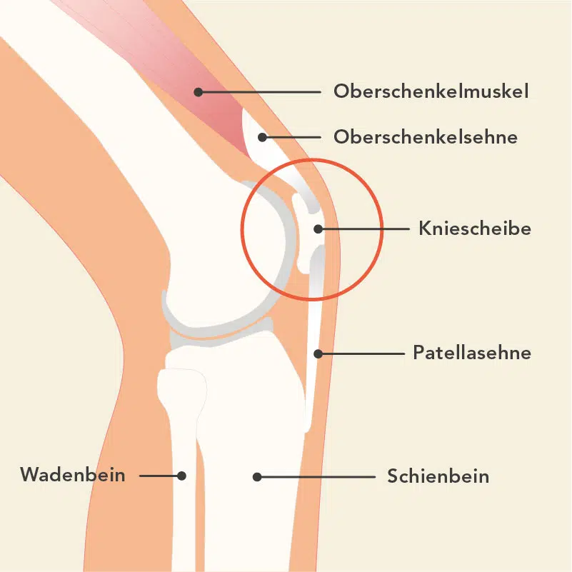 Grafik von einem Knie von der Seite. Man sieht Oberschenkel und Unterschenkel aufeinandertreffen. Die Kniescheibe sitzt vorne am Oberschenkelknochen und ist über die Patellasehne mit Schienbein und Oberschenkelsehne verbunden.