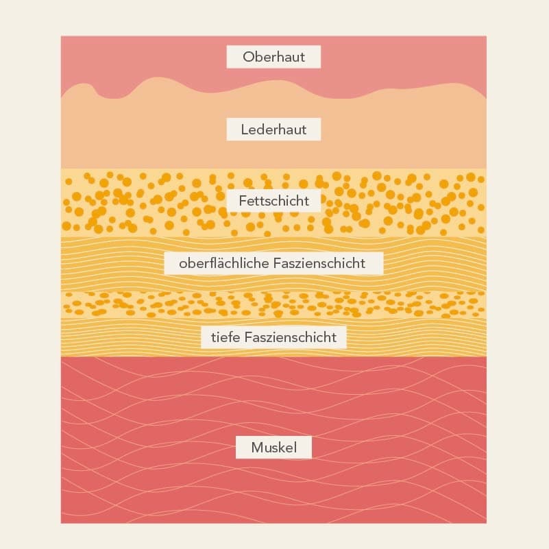 Grafik Querschnitt Haut mit Oberhaut, Lederhaut, Fettschicht, oberflächlicher Faszienschicht, tiefer Faszienschicht, Muskelgewebe