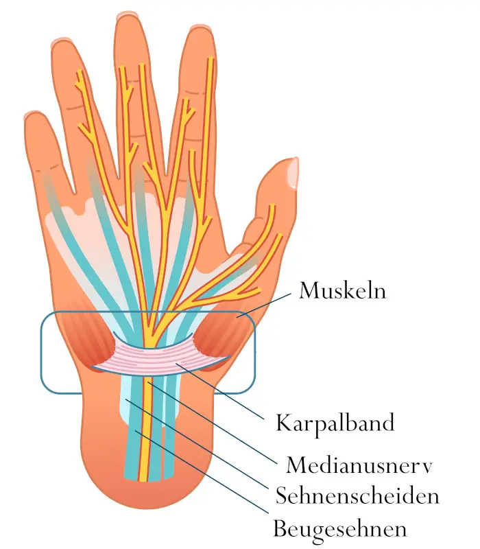 Grafik einer Hand mit Nerven, Muskeln und dem Karpalband.