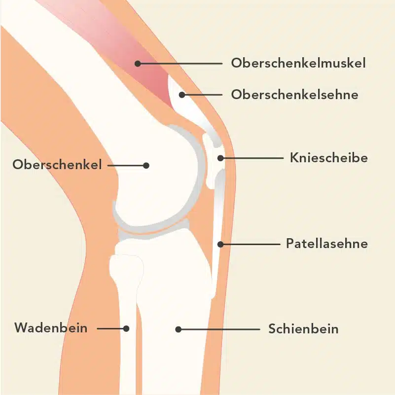 Die anatomische Grafik zeigt den Aufbau des Kniegelenks von der Seite. Die Knochen von Oberschenkel, Wadenbein und Schienbein sind zu erkennen sowie die Kniescheibe, Patellasehne und Oberschenkelmuskel.