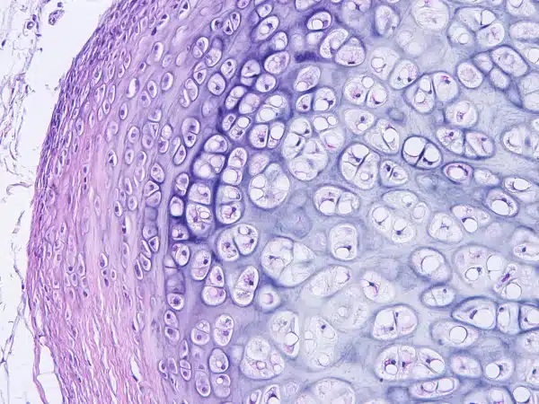 Histologie des Bindegewebes des menschlichen Knorpels, Foto von Hyalin und elastischem Knorpel aus Mikroskop-Sicht