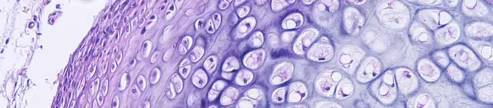 Histologie des Bindegewebes des menschlichen Knorpels, Foto von Hyalin und elastischem Knorpel aus Mikroskop-Sicht