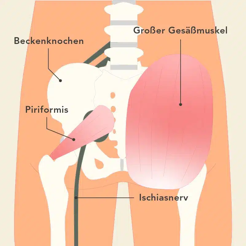 Die Grafik zeigt die Beckenknochen sowie die Gesäßmuskulatur des Menschen. Dazwischen ist der Verlauf des Ischiasnervs zu erkennen.
